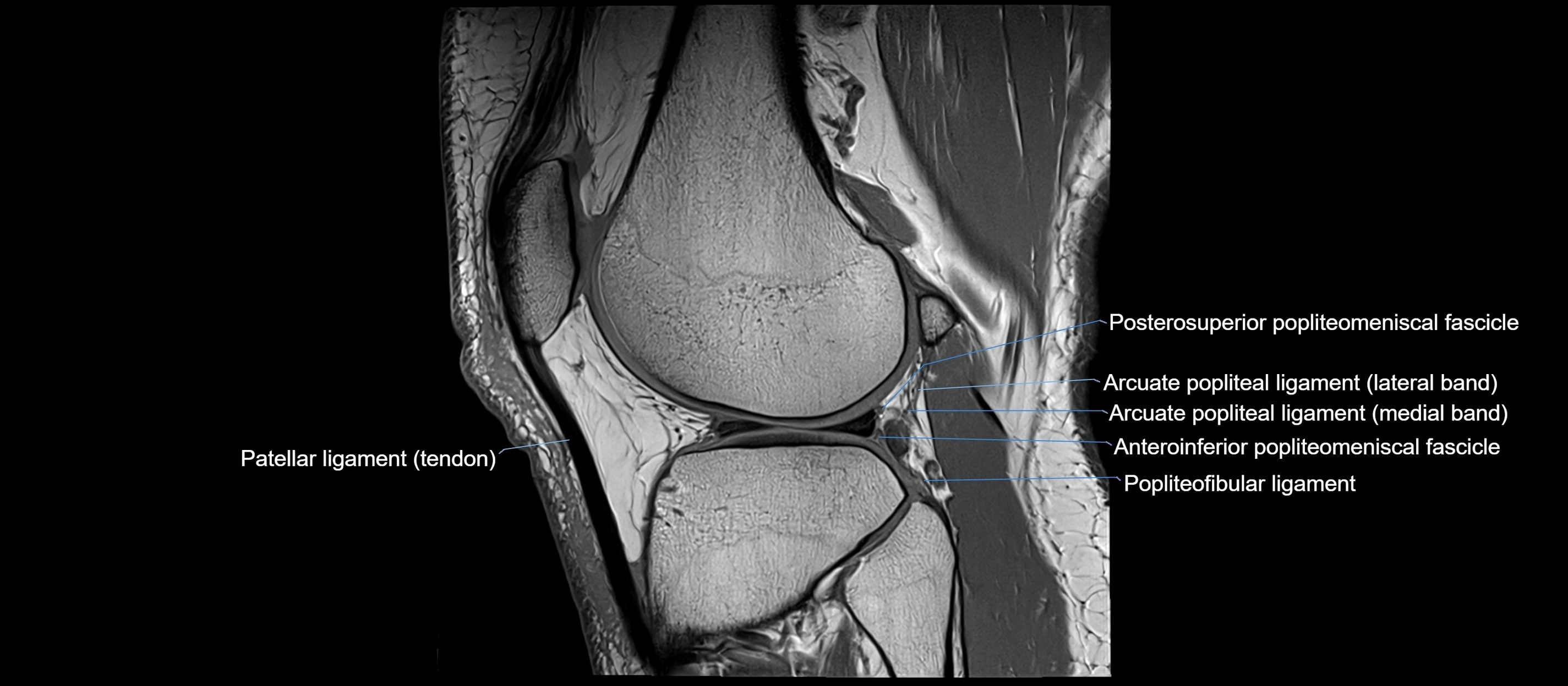MRI sagittal  ligaments cross sectional anatomy 3T  radiology  image-img-00001-00035.webp